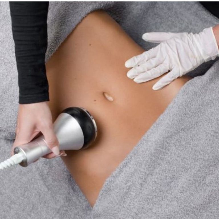 Lipocavitation Lyon et Villeurbanne